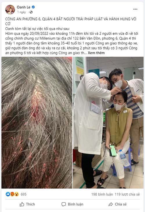 Hoa hậu Oanh Lê bị Công an đánh?